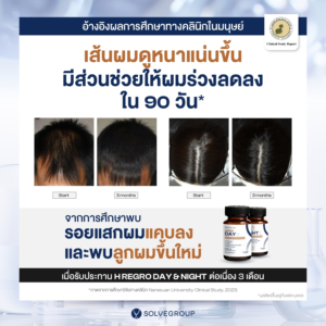 เอช รีโกร เดย์ และเอช รีโกร ไนท์