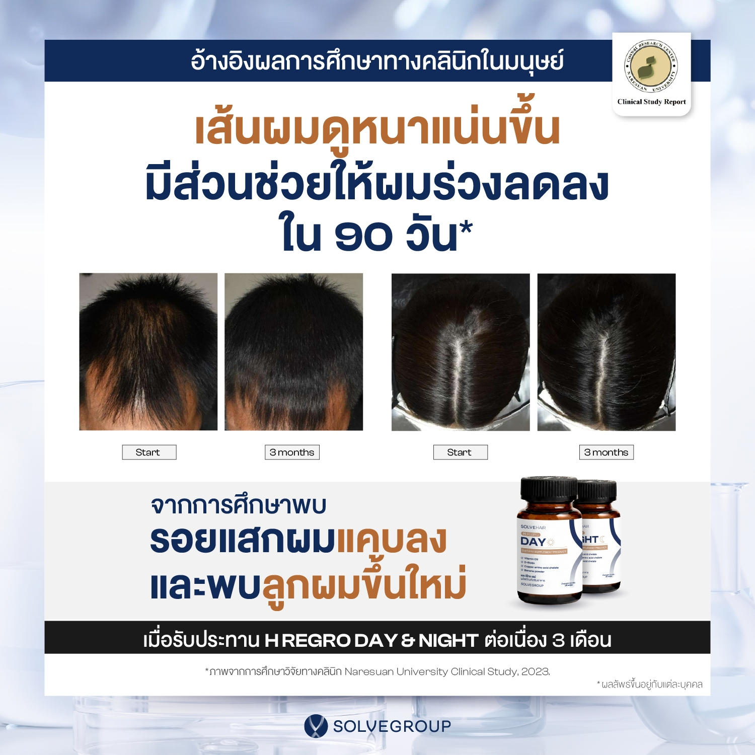 เอช รีโกร เดย์ และเอช รีโกร ไนท์