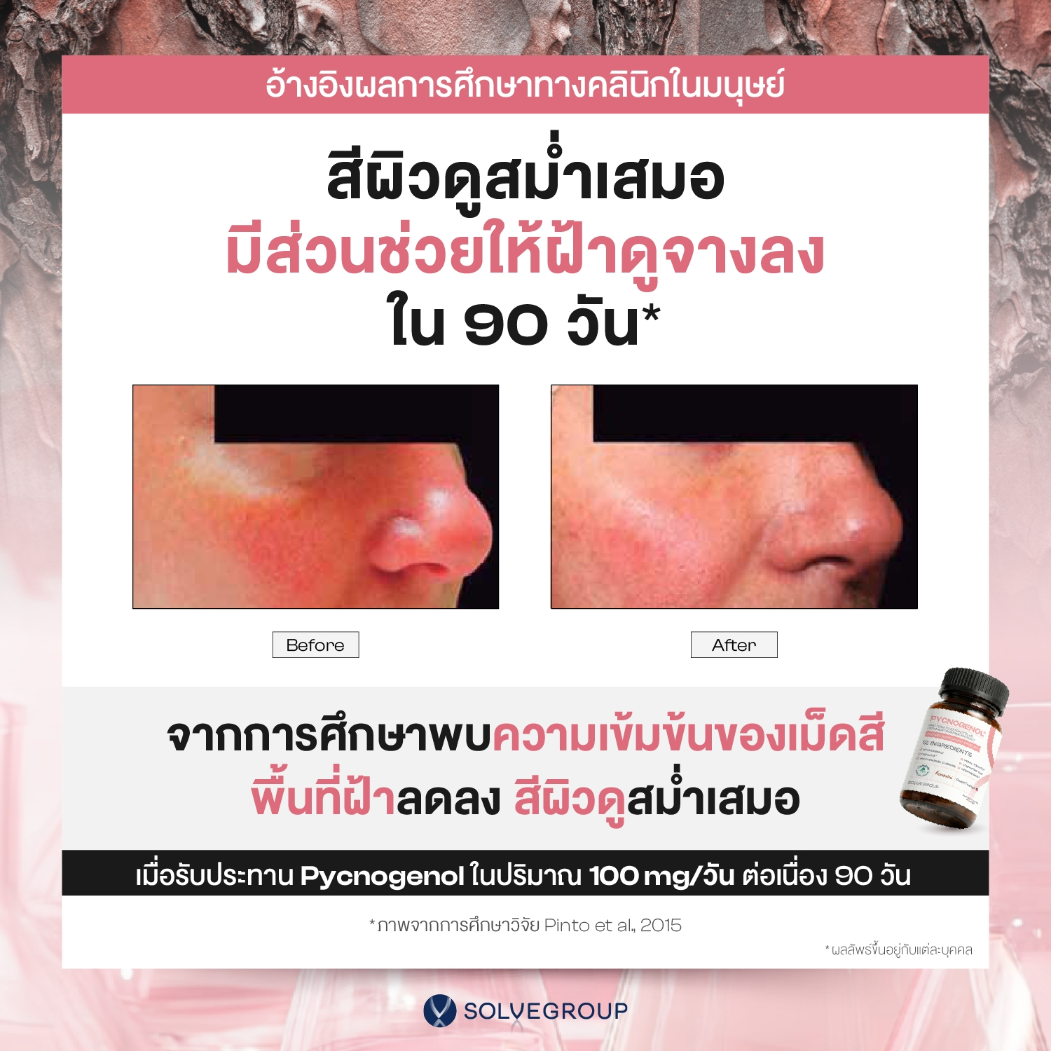 PYCNOGENOL